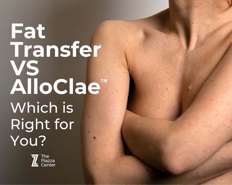 diffrence between AlloClae Fat Transfer