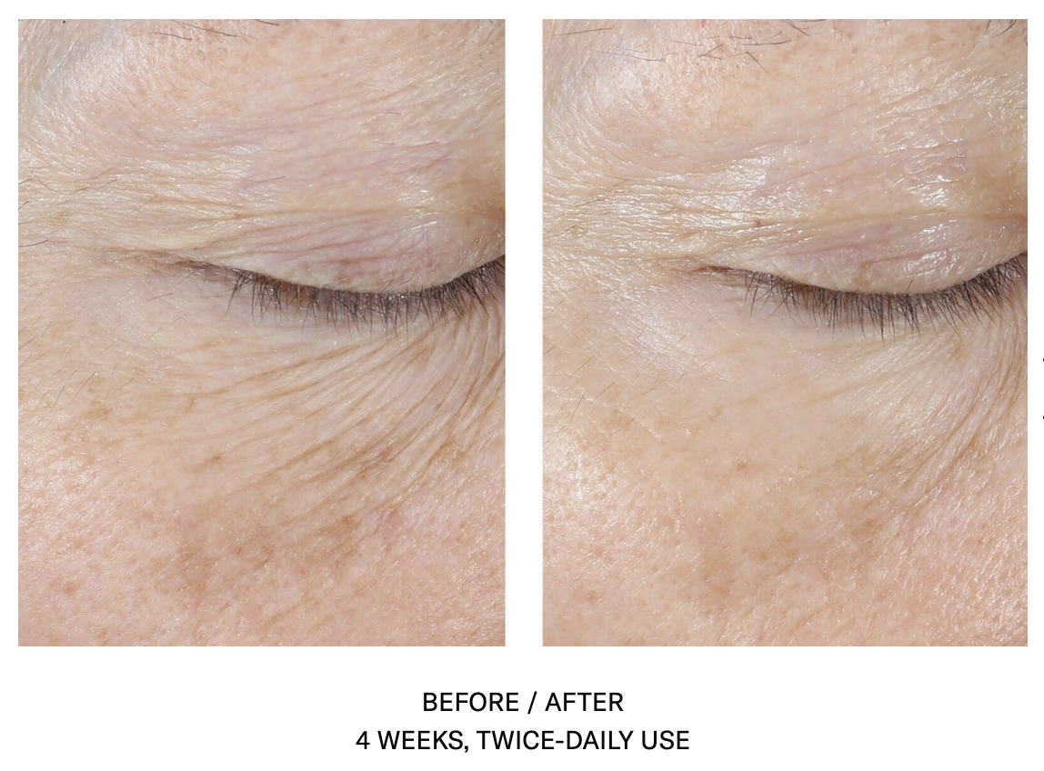 InterFuse Eye Cream Before and After