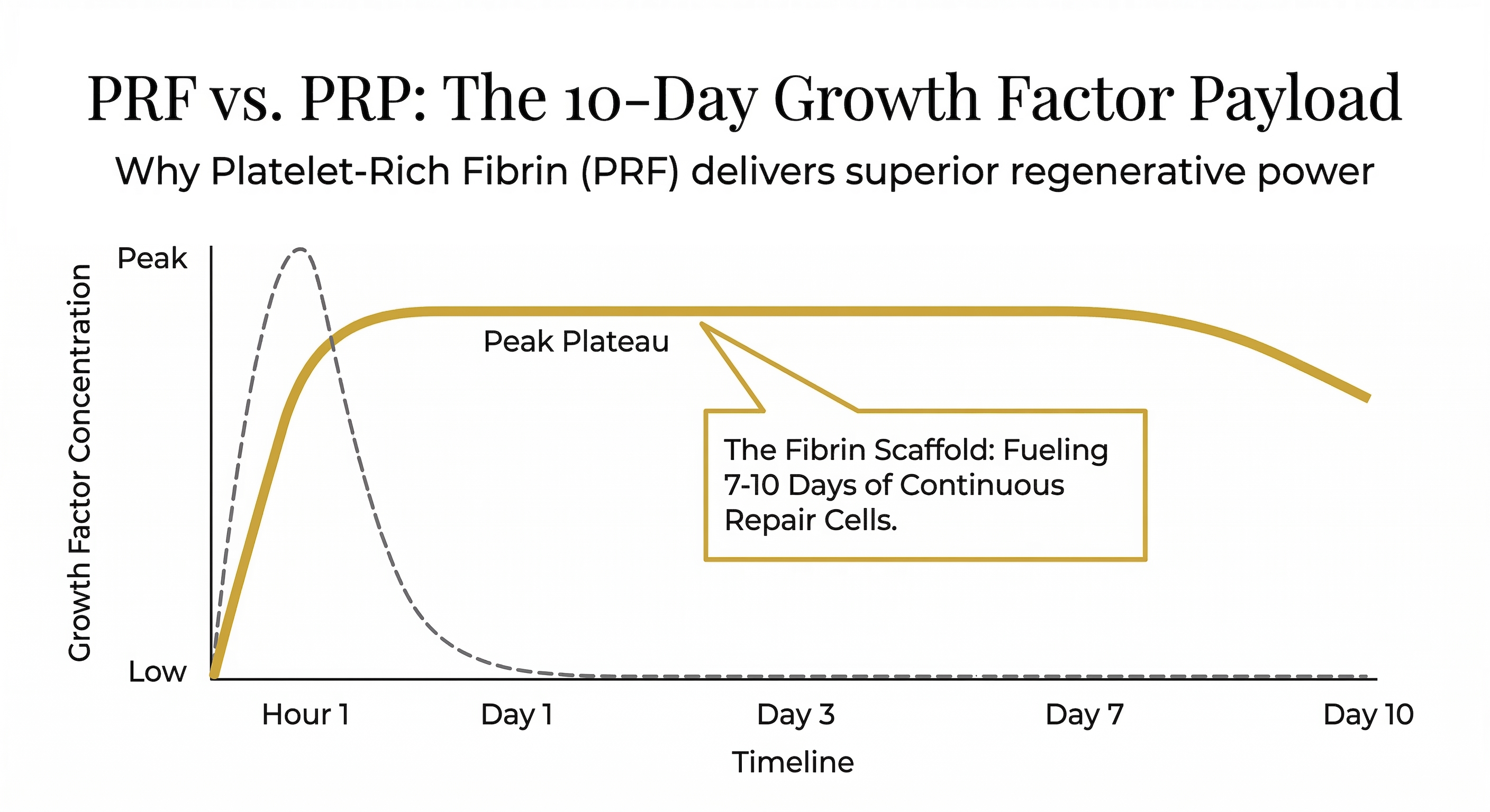 PRP vs PRF 10-Day Growth Factor Release Timeline