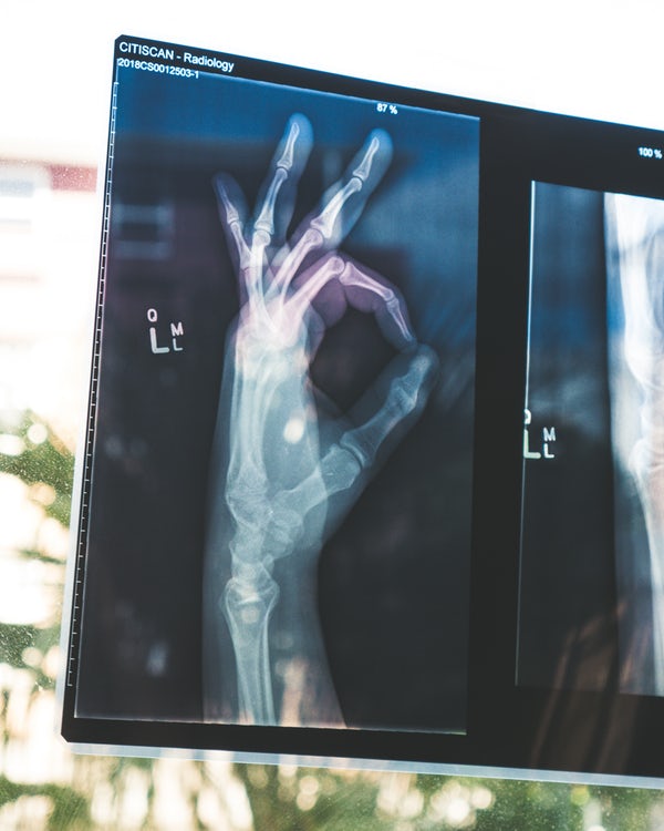 x-ray picture