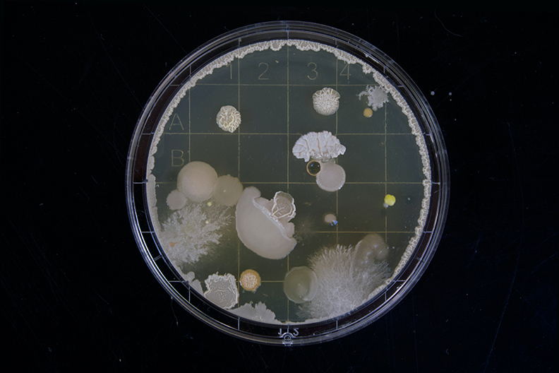 Mold on a petri dish