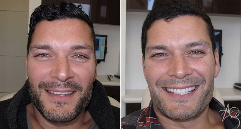 Smile Makeover Before & After Gallery - Patient 167602692 - Image 1