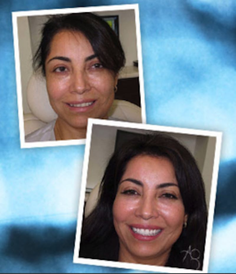Patient's cosmetic dentistry results