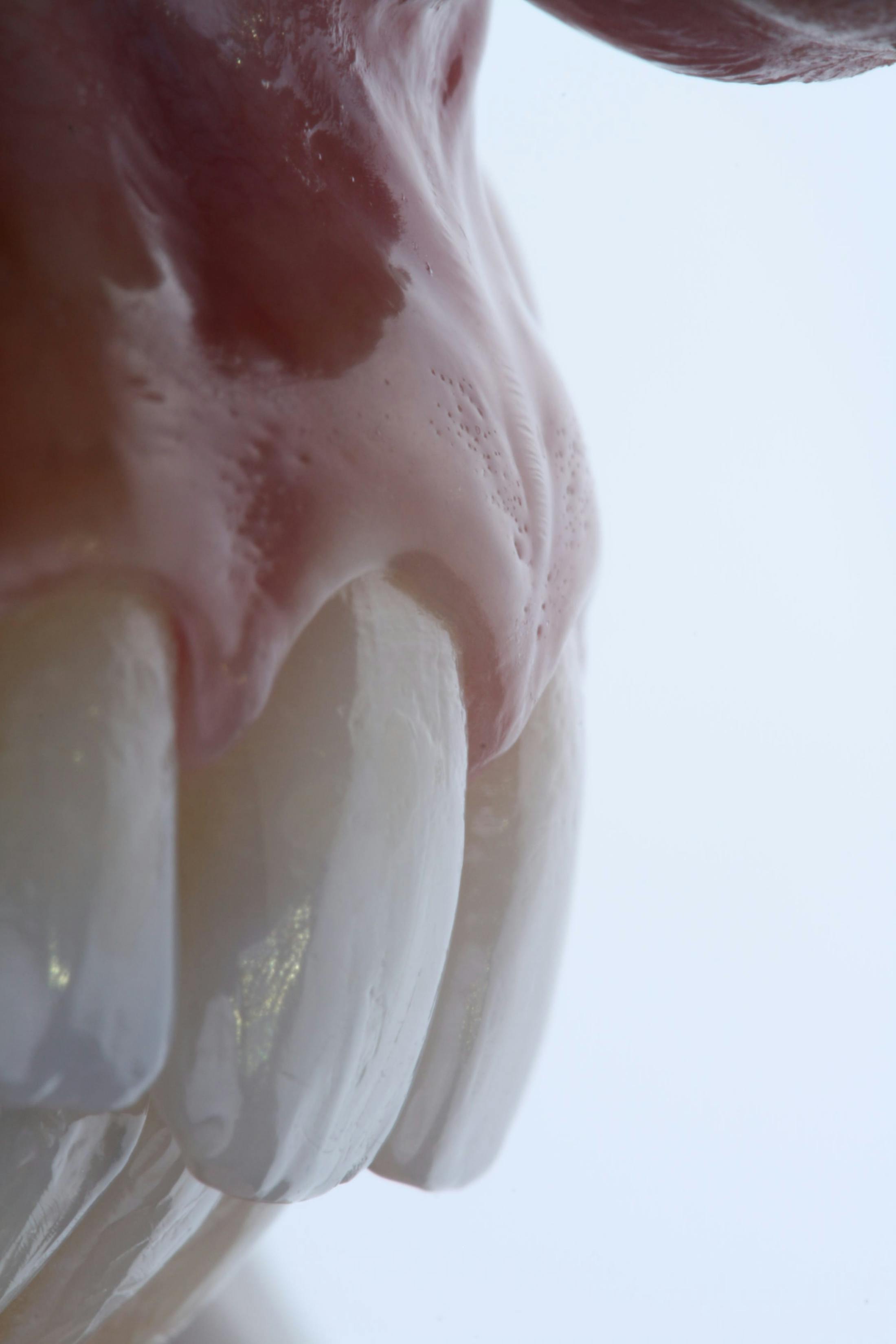 Periodontics
