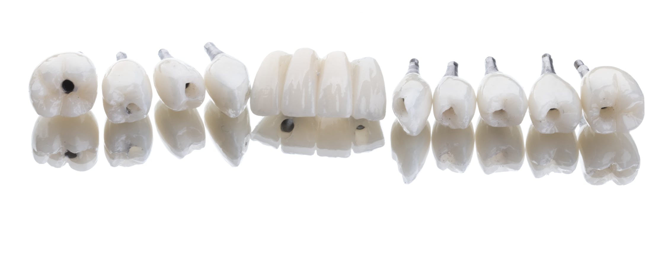 Dental Implant Crowns