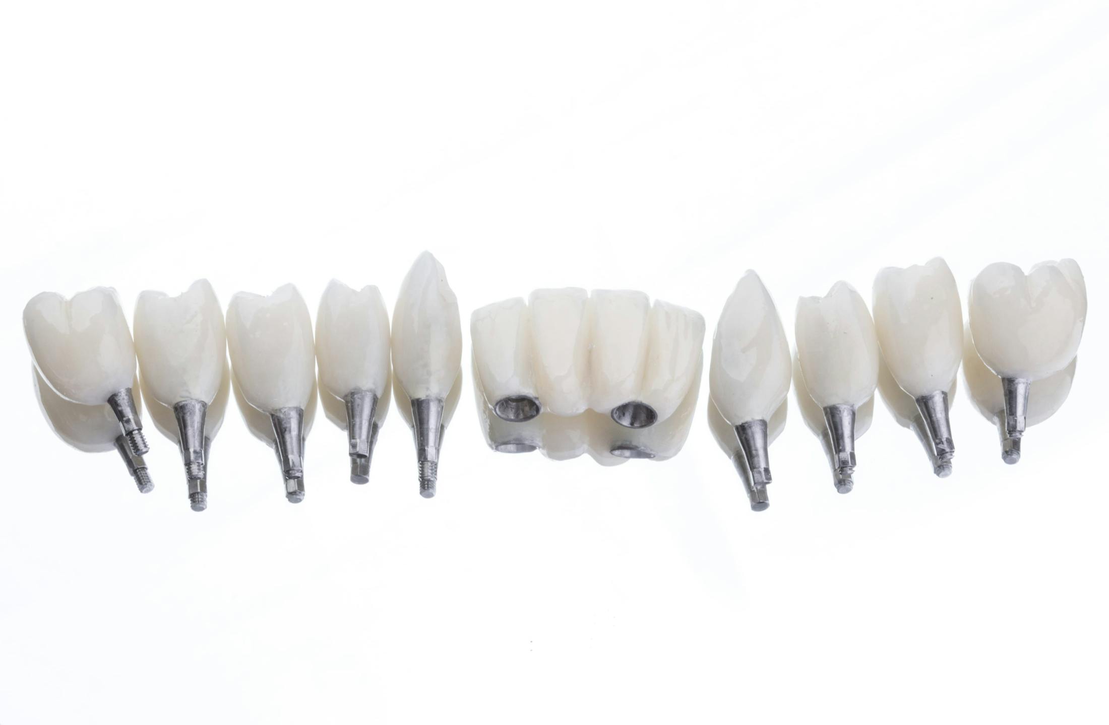 Dental Implant Crowns