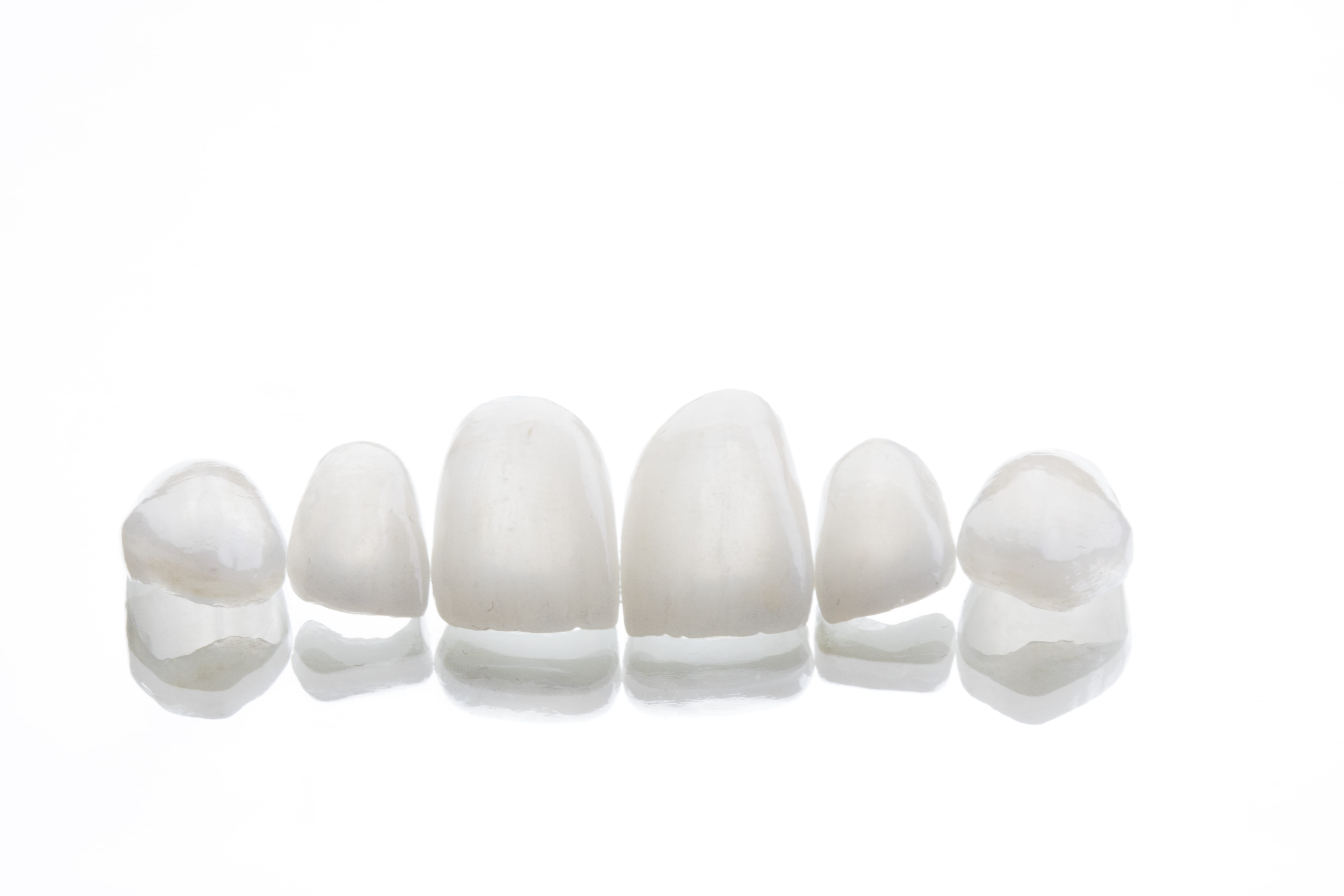 Porcelain Veneers in Beverly Hills