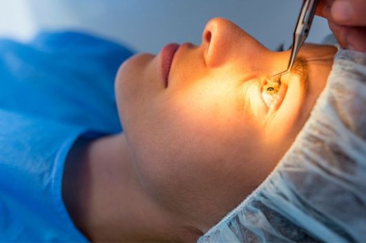 Woman undergoing eye surgery