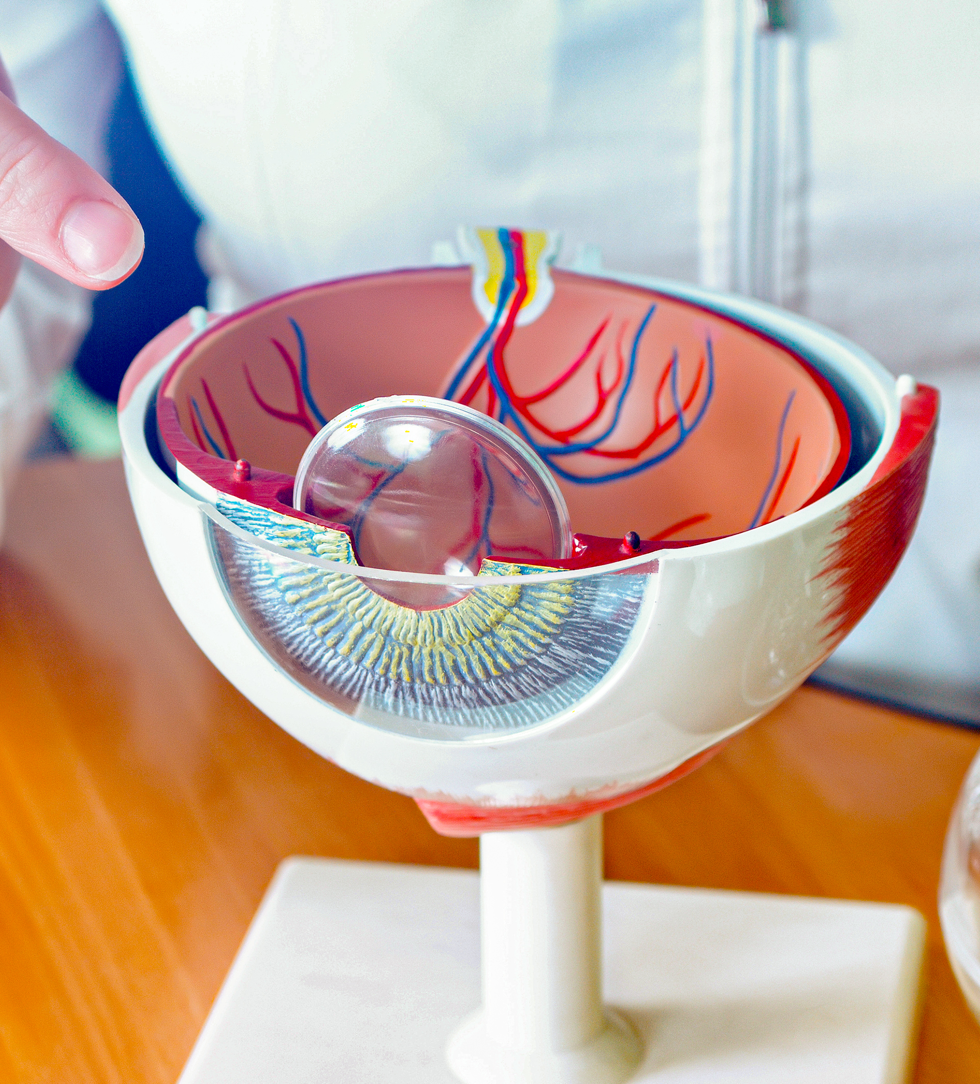 Anatomical cross-section model of a human eye displaying the retina, optic nerve, and internal eye structures used for ophthalmology education and retinal health discussions.