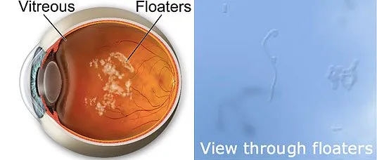 eye anatomy