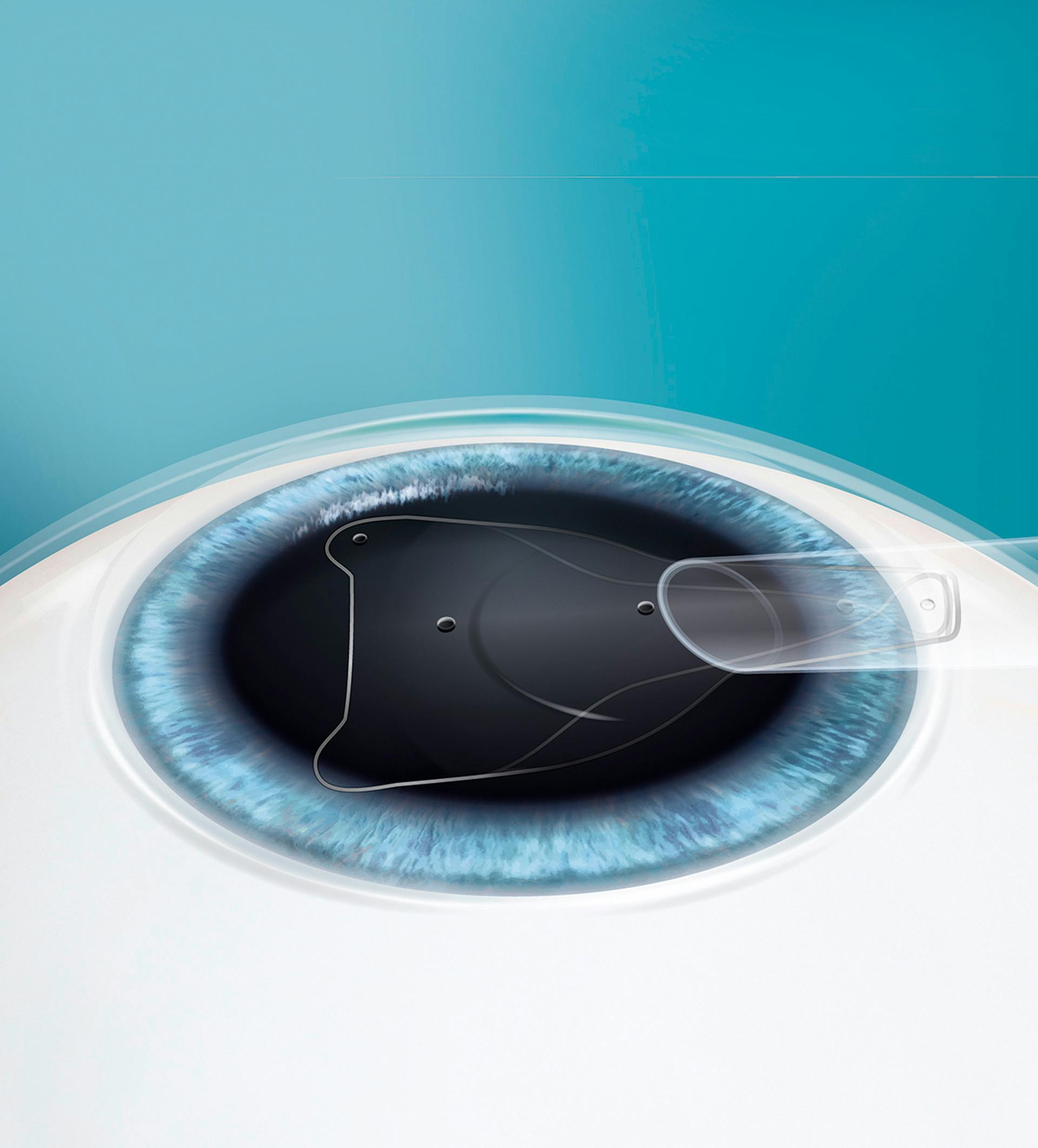 animated eye treatment