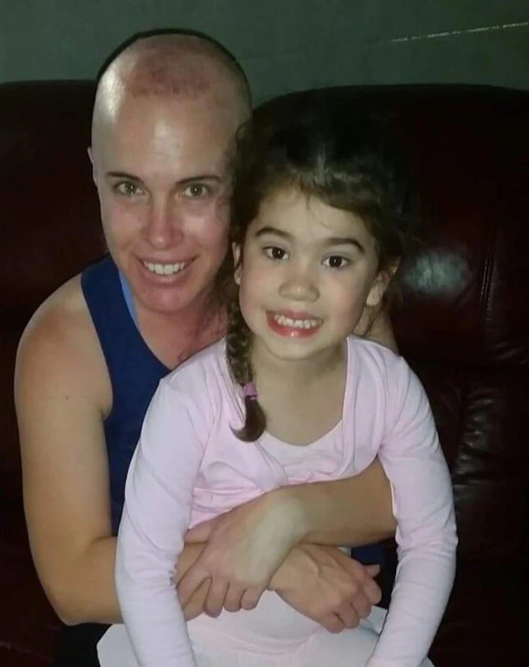 Mother with bald head hugging young girl