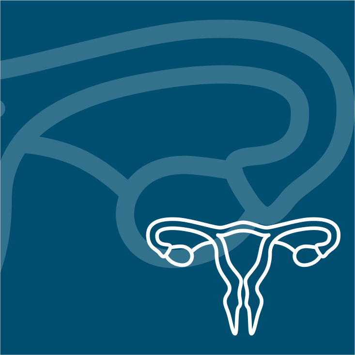 Understanding Ovarian Cancer