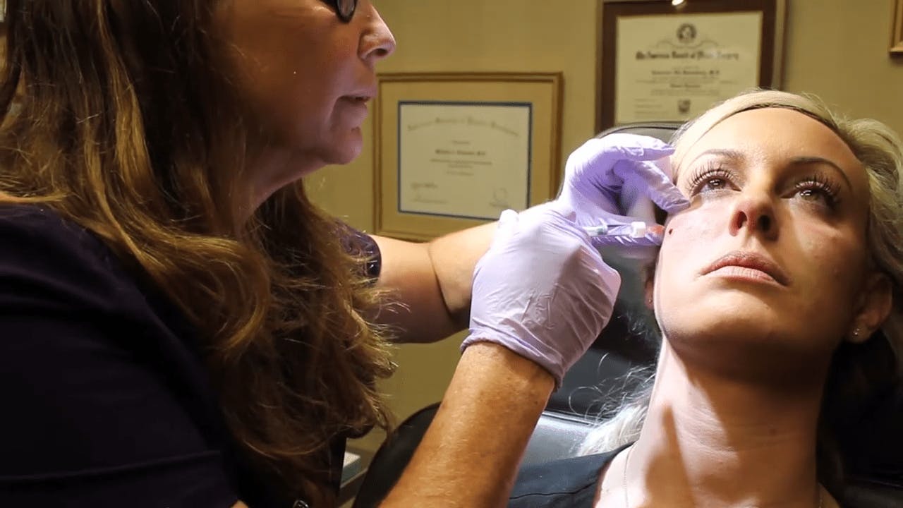 restylane video thumbnail