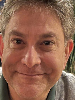 Injectables Before & After Gallery - Patient 174146481 - Image 2