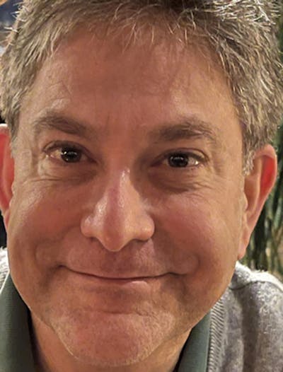 Botox / Dysport Before & After Gallery - Patient 174146460 - Image 2