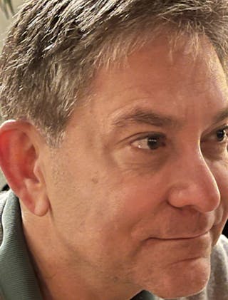 Botox / Dysport Before & After Gallery - Patient 174146460 - Image 6