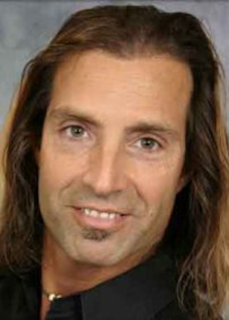 Male Surgical Gallery Before & After Gallery - Patient 166658376 - Image 2