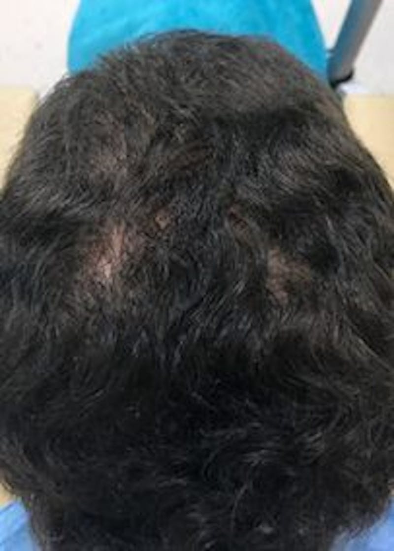 Non-Surgical Gallery Before & After Gallery - Patient 166658838 - Image 3