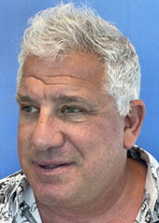 Non-Surgical Gallery Before & After Gallery - Patient 179737922 - Image 6