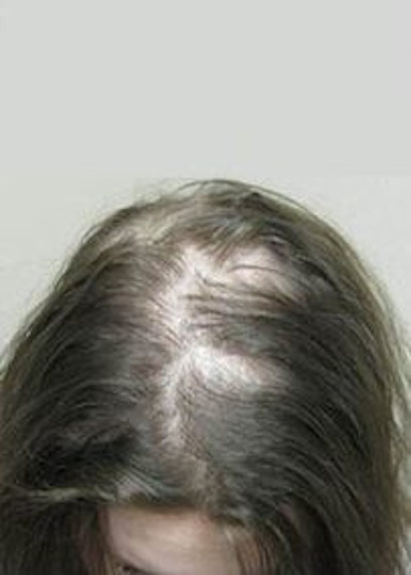 Non-Surgical Gallery Before & After Gallery - Patient 166658906 - Image 1