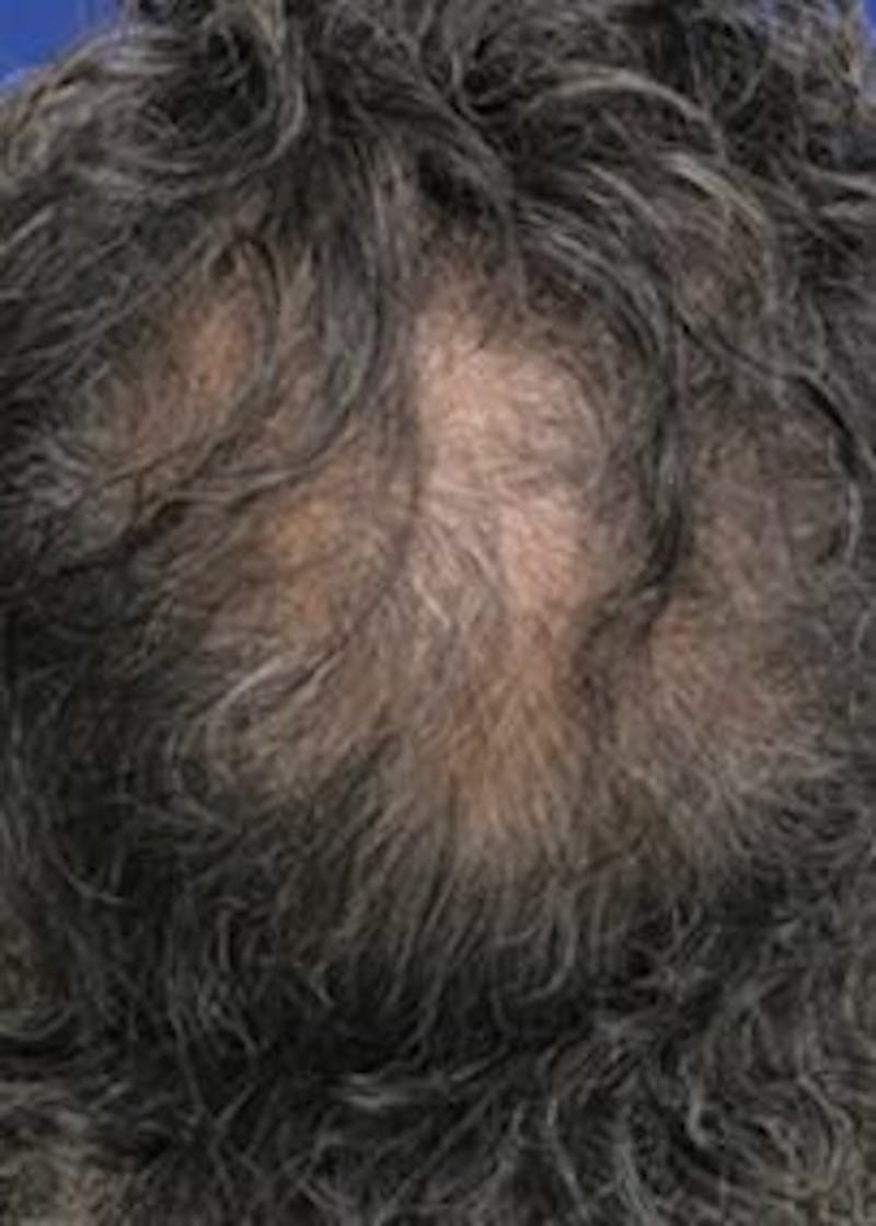Non-Surgical Gallery Before & After Gallery - Patient 166658931 - Image 3