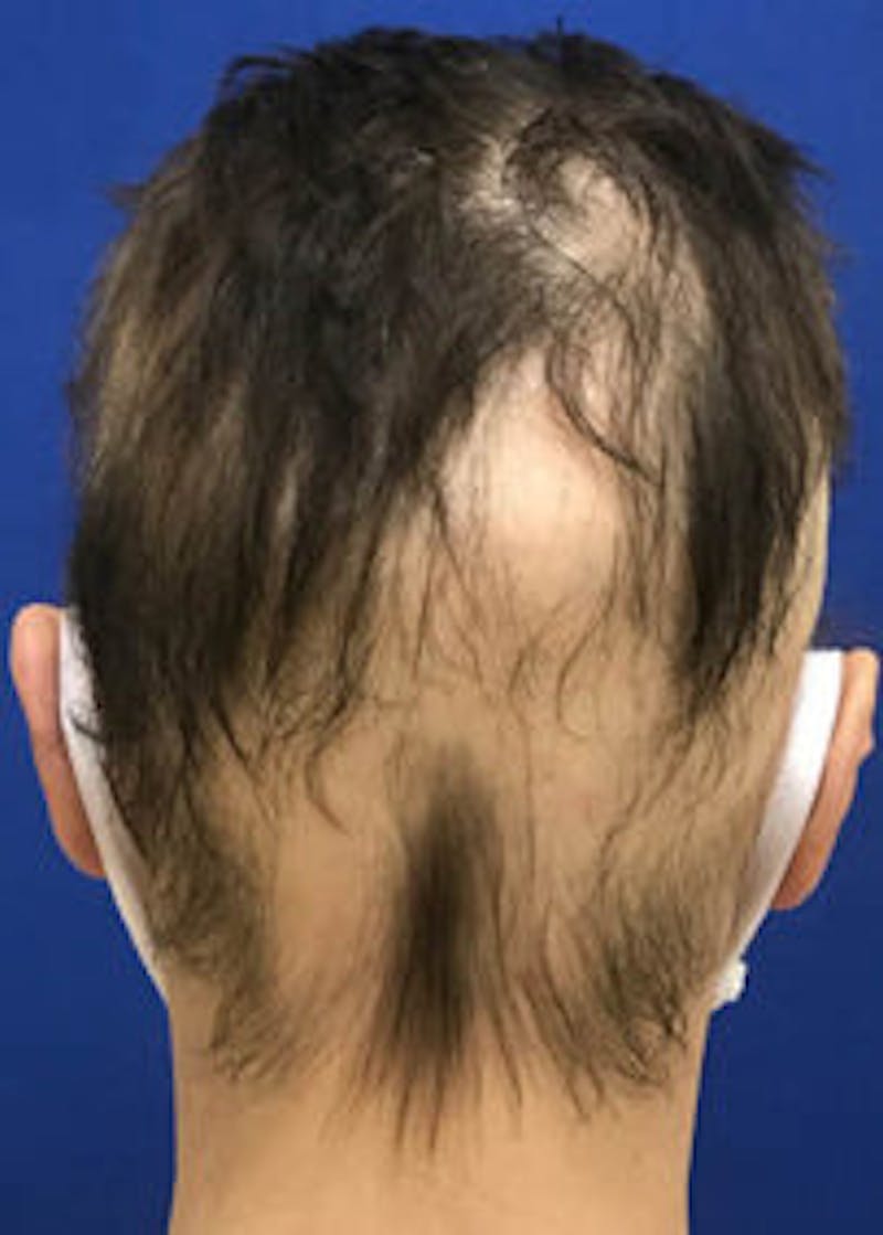 Non-Surgical Gallery Before & After Gallery - Patient 166658947 - Image 1