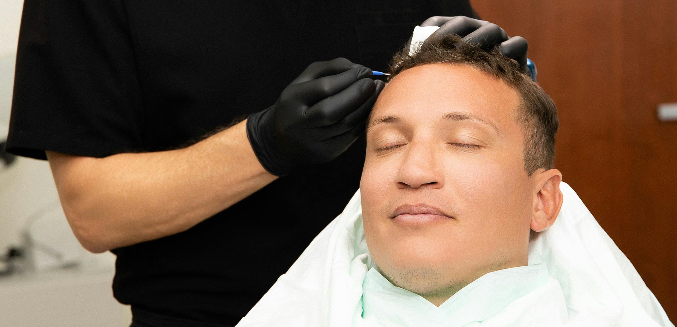 patient getting a surgical hair procedure