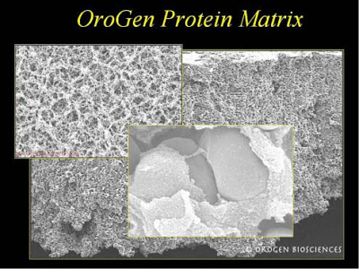 Extra Cellular Matrix (ECM) and PRP w