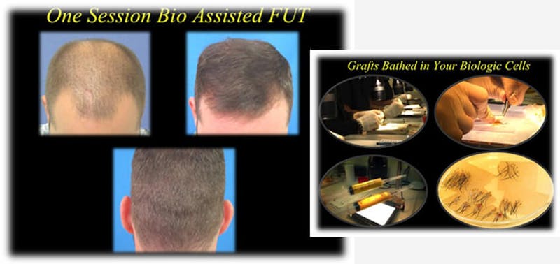 Before and after photos of hair