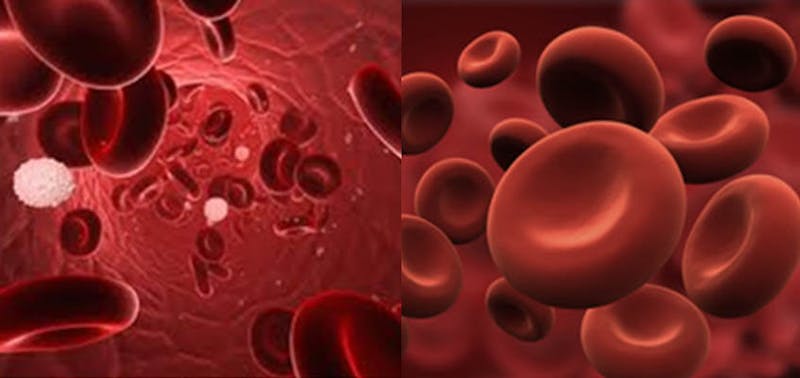 red cells