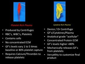 Platelet Rich Plasma