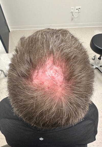 Non-Surgical Gallery Before & After Gallery - Patient 179729371 - Image 1