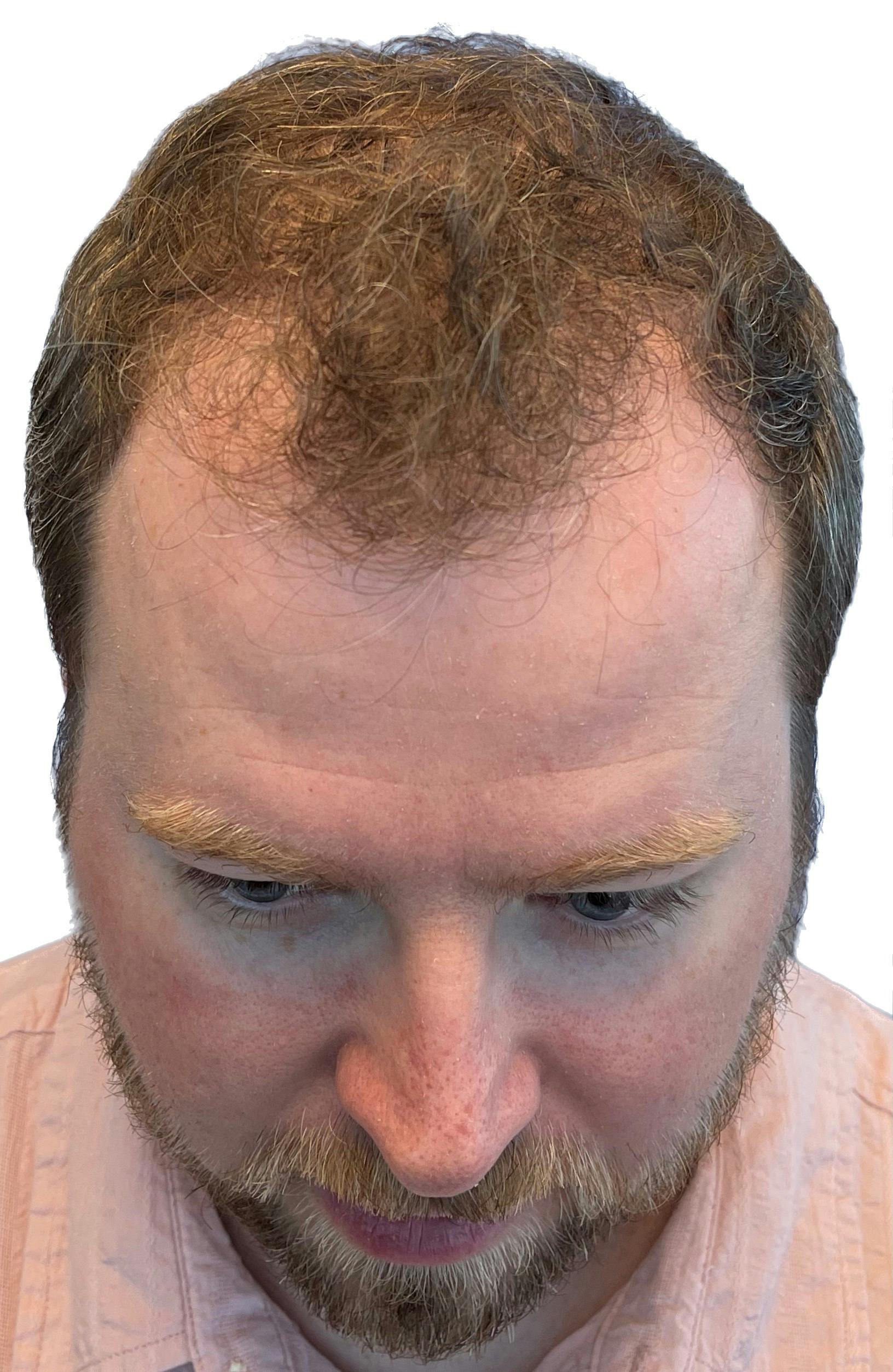 procedure
