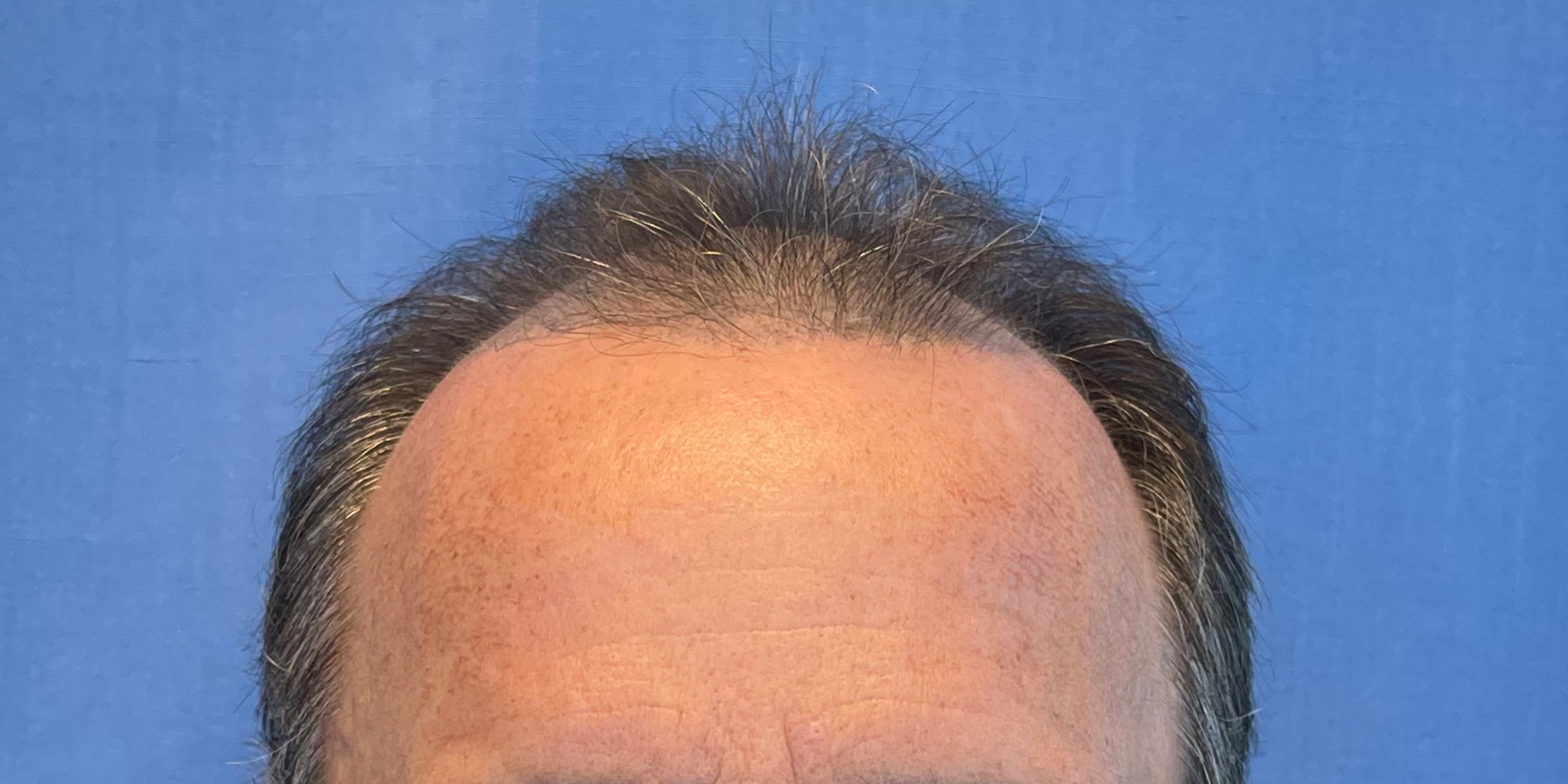 Male Extra Review Are The Results Even Better With The New Formula?