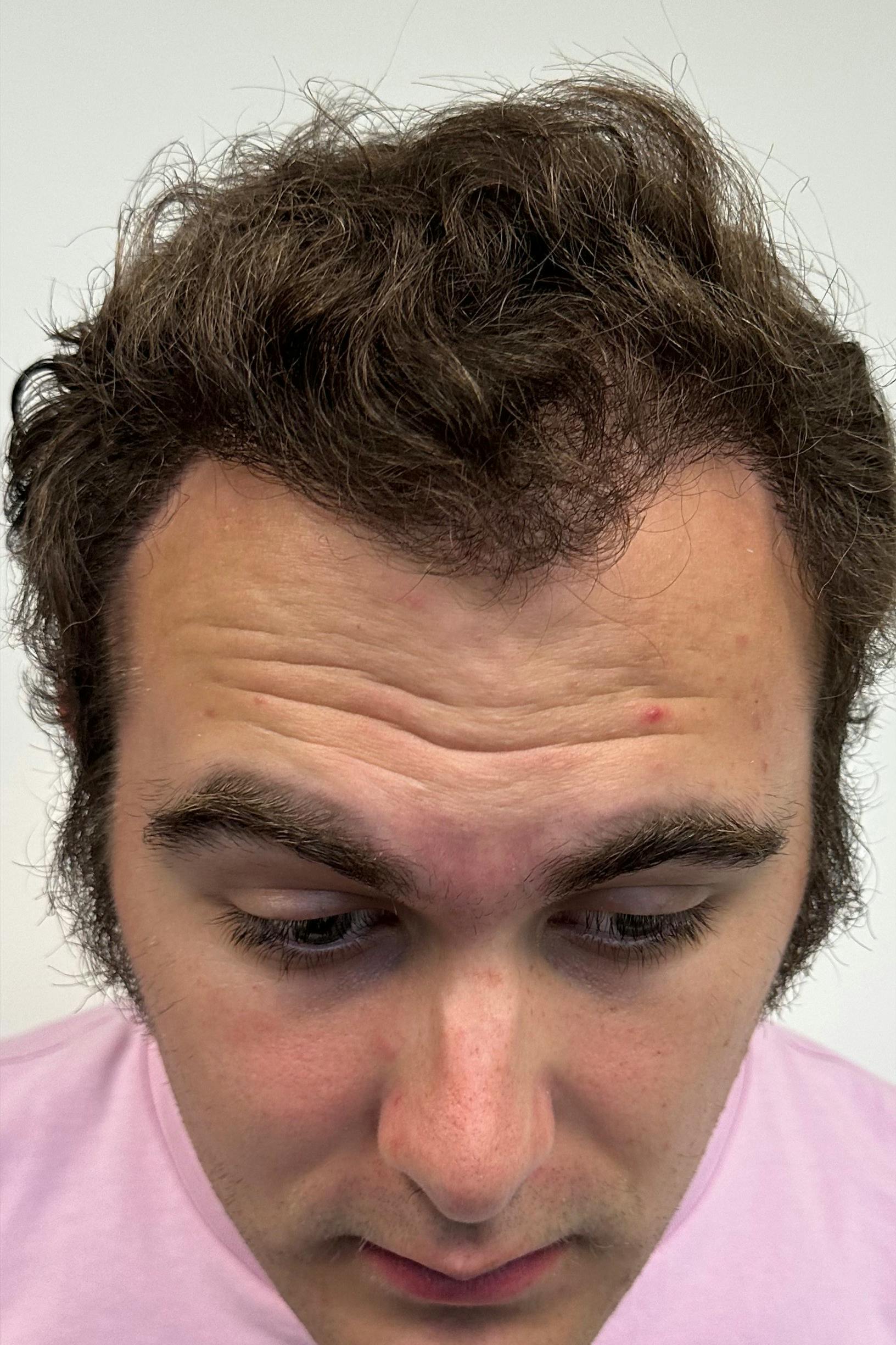 procedure