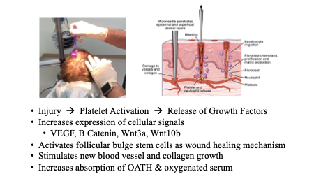 Microneedling Infographic