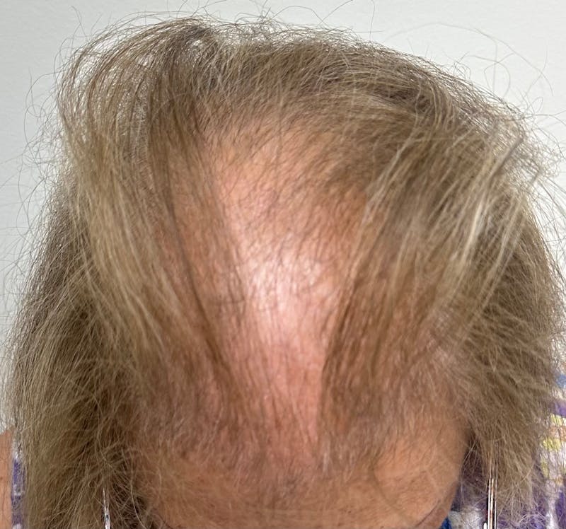 Female Surgical Gallery Before & After Gallery - Patient 191596 - Image 9