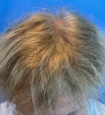 Non-Surgical Gallery Before & After Gallery - Patient 267760 - Image 1