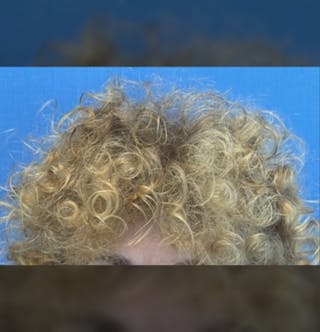 Non-Surgical Gallery Before & After Gallery - Patient 267760 - Image 4