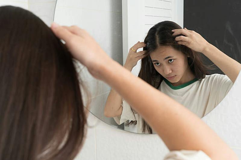 Woman Looking at Her Scalp