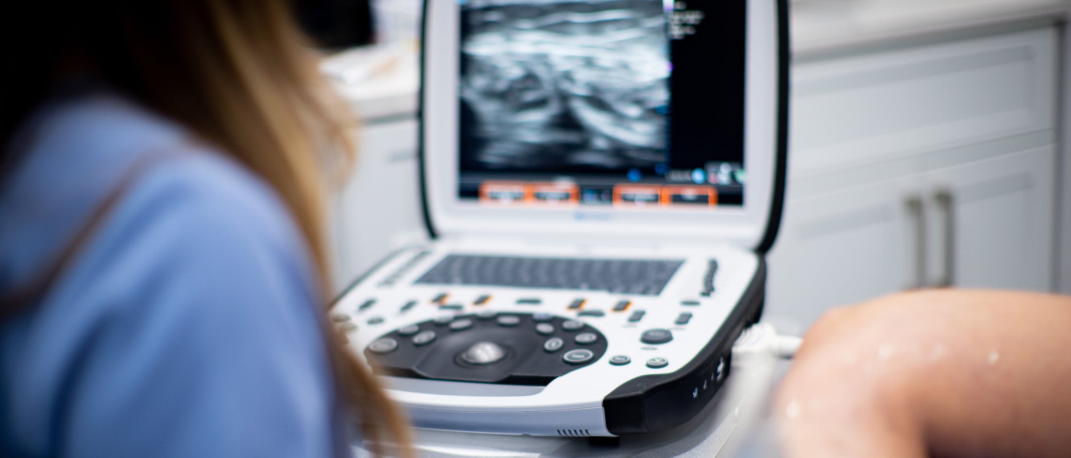 Ultrasound Machine