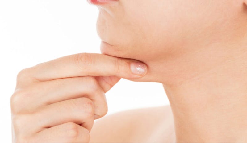 A double chin can result from excess body fat, facial muscle weakness, or aging.