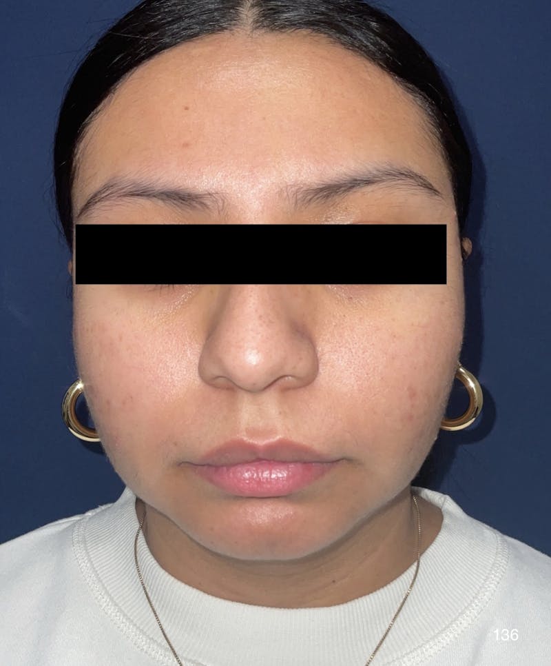 136 before