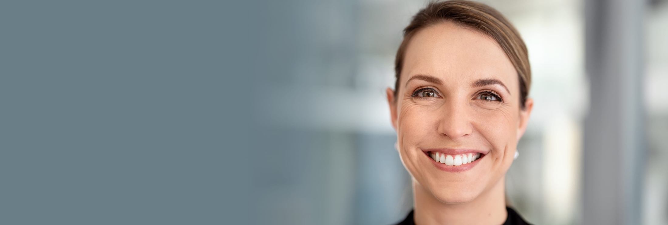 Female patient who received VirtueRF Microneedling treatment