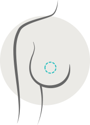 Diagram of a breast