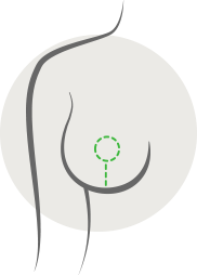 Diagram of a breast