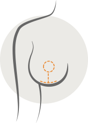 Diagram of a breast