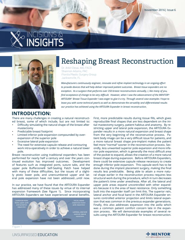 Reshaping Breast Reconstruction