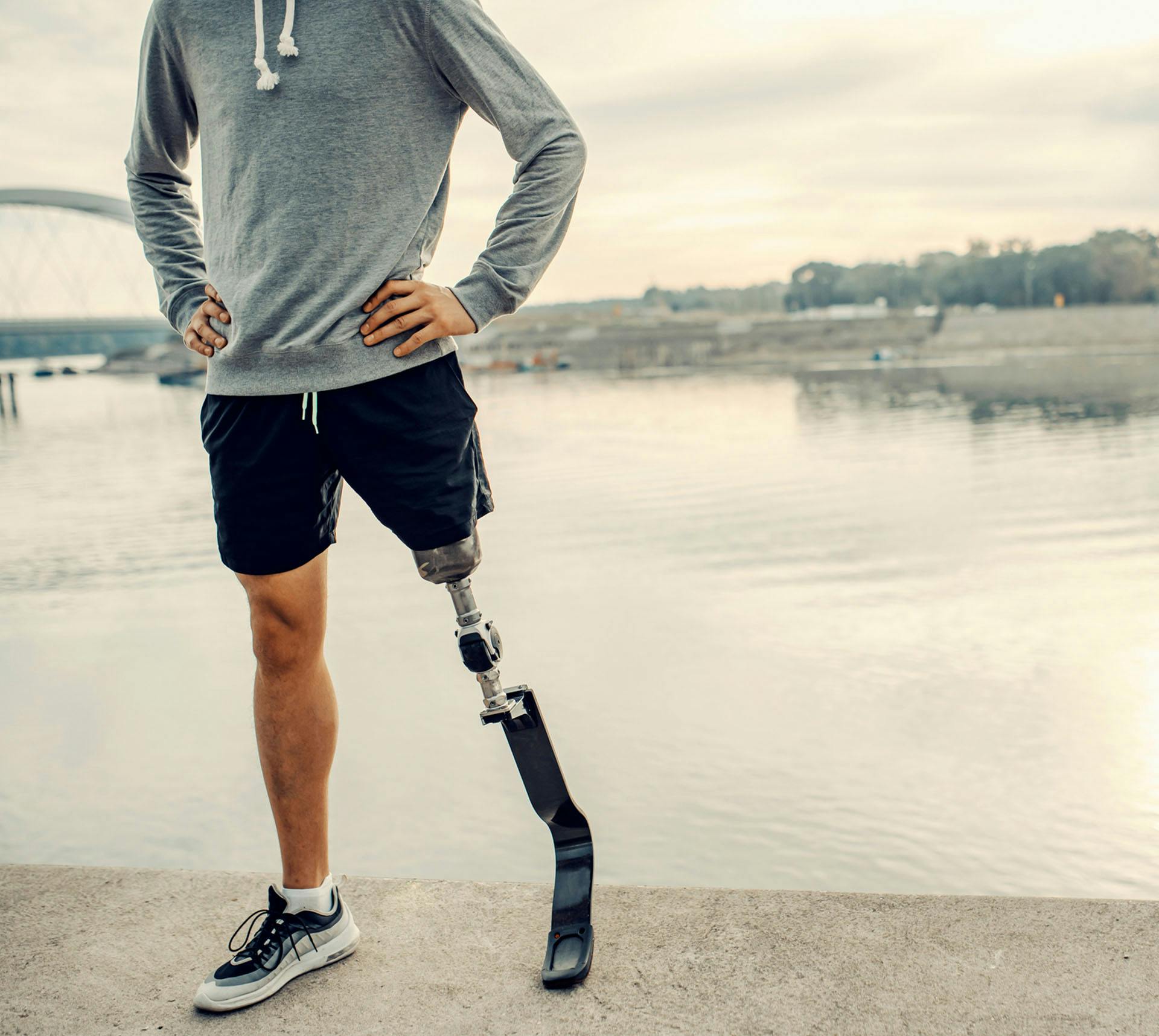 Man with prosthetic leg